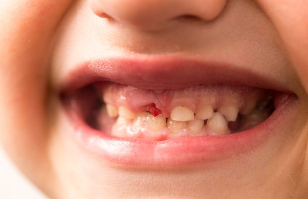 Abby’s Joke: Why Is The Tooth Fairy So Smart? Abby’s Joke: Why Is The Tooth Fairy So Smart?